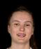 https://img.longzhuzhibou.com.cn/img/basketball/player/60b93364eba88d25f82b39717821fb86.png